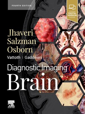 cover image of Diagnostic Imaging